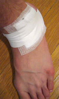 ねんざした左足首