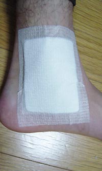 ねんざした左足首